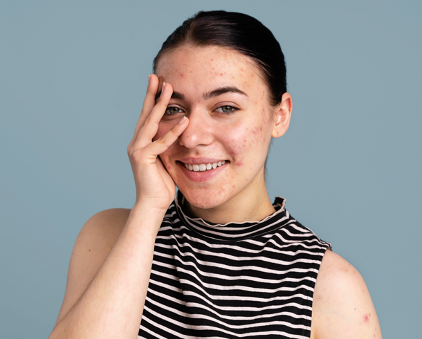 High-End Retouching – before example: Portrait & Beauty Retouching